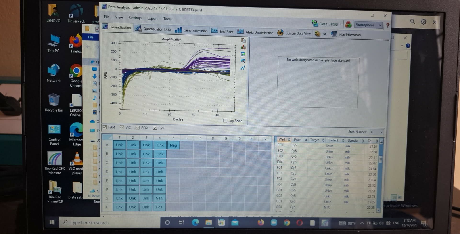 Slider Image: PCR EPEC Gene ,VL Surkhet